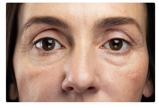 Close up of a woman's eyes to show how tear throughs are behind tired looking eyes 